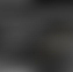 What is IVDD? - IVDD Explained Simply