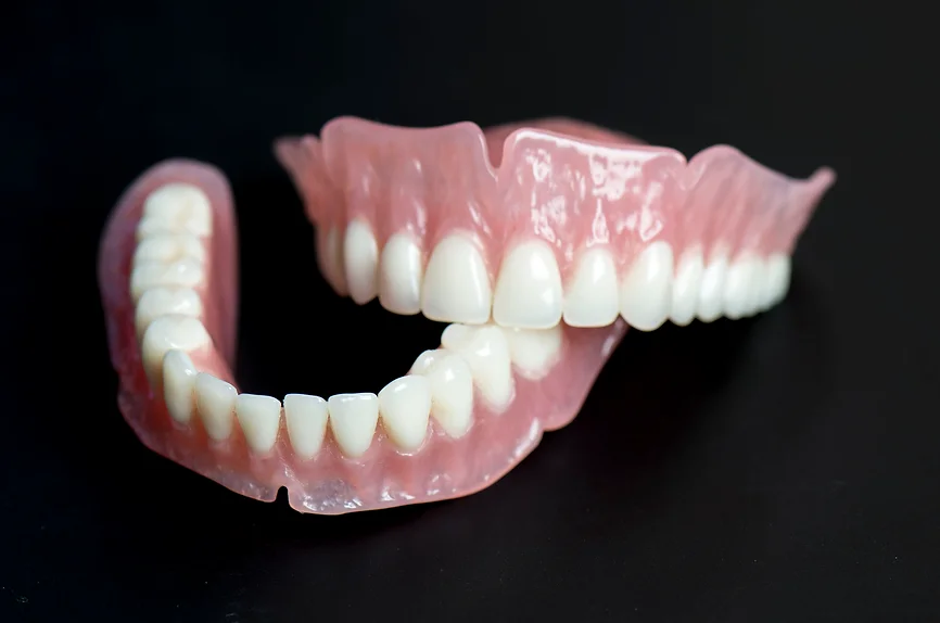 Removables Steinwayfisher