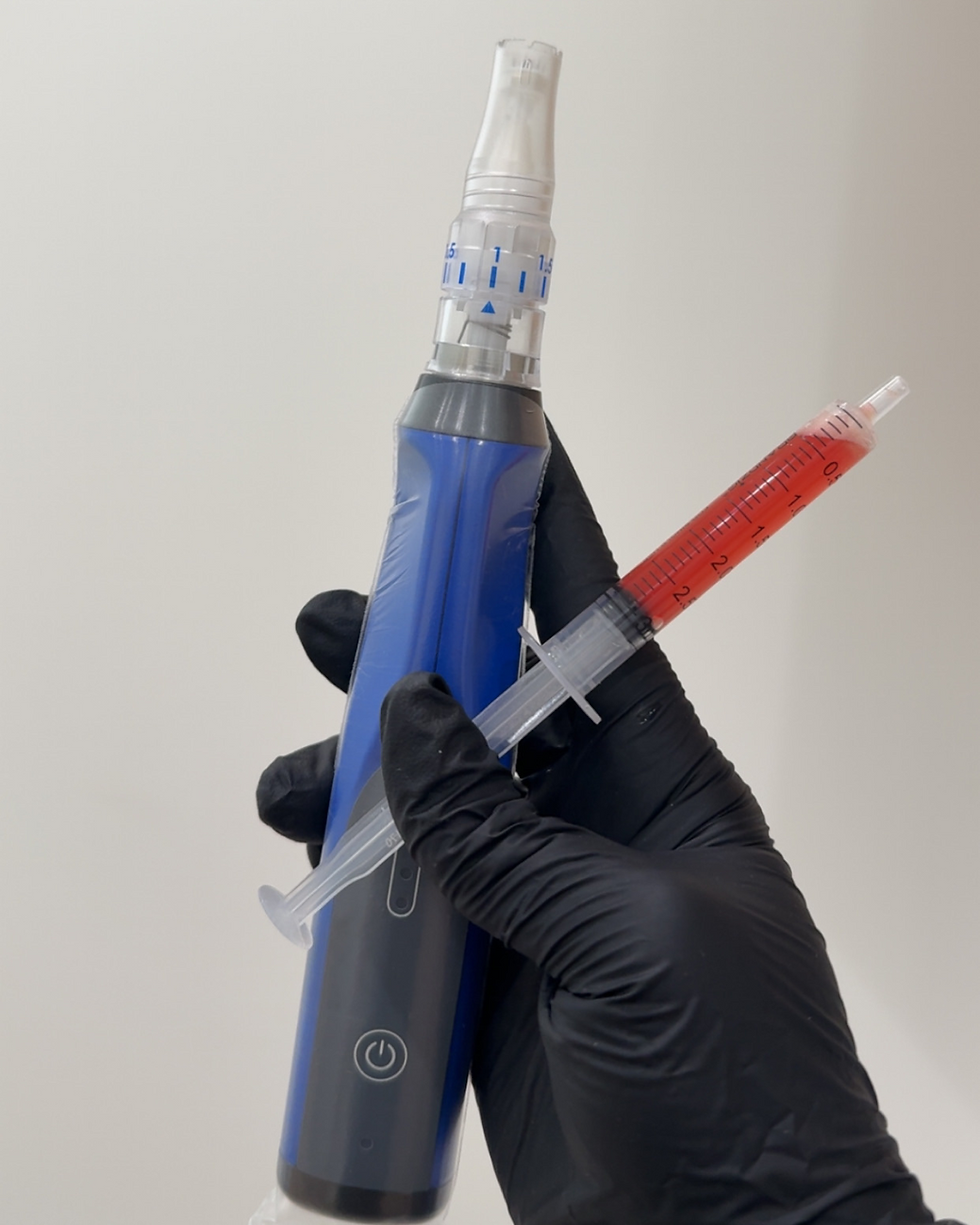 microneedling with prf
