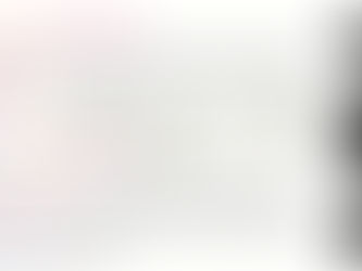 Tipos de fracturas (clasificación & factores que influyen en la recuperación)