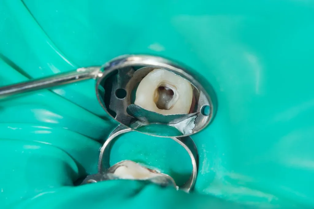 Endodontija