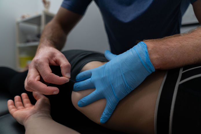 Physiotherapist is applying IMS to relieve patient's hip area from pain. 