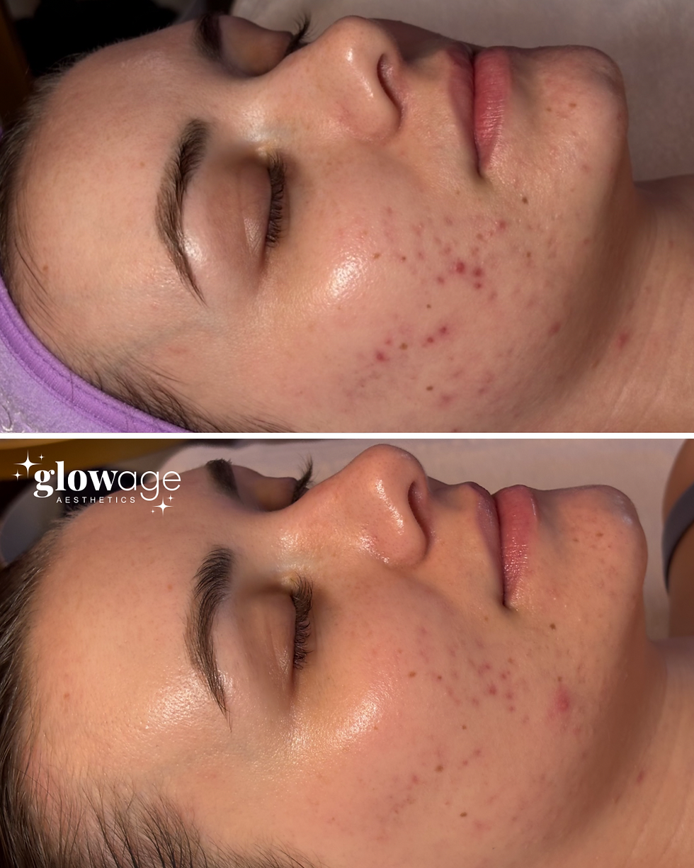 GlowAge Social Media (1080 x 1350 px) 8.PNG