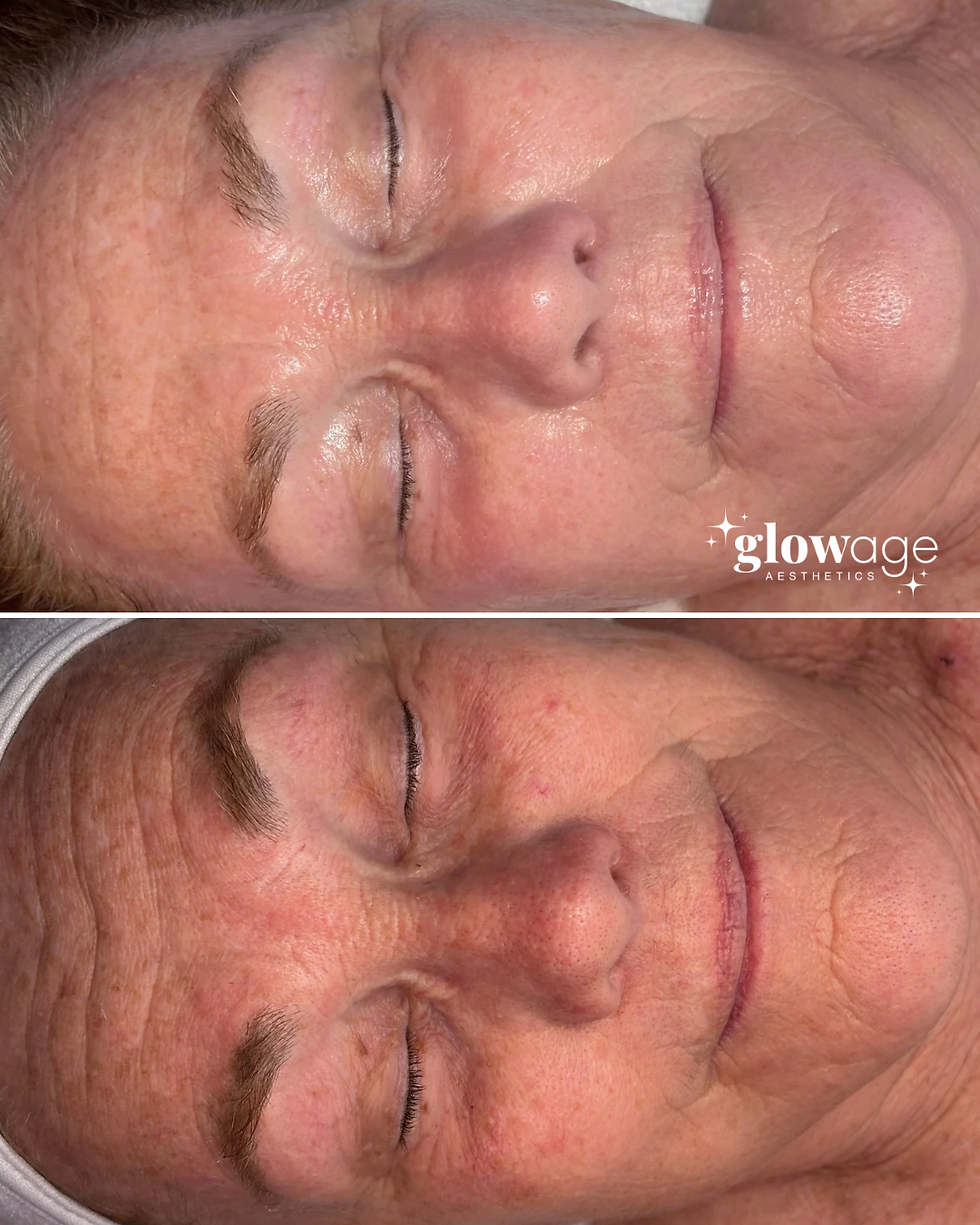 GlowAge Social Media (1080 x 1350 px) 6.PNG