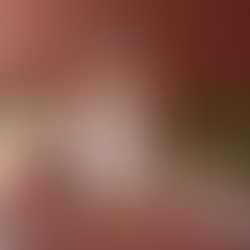 Gül Suyu: Doğanın En Değerli Cilt Hediyesi