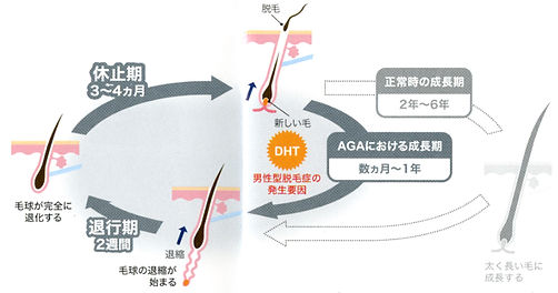 安田皮フ科_男性型脱毛症(AGA)