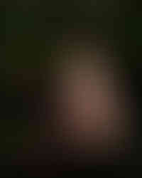 Implied nude of Misuzu crouched in a woodland with strong sunlight and shadows