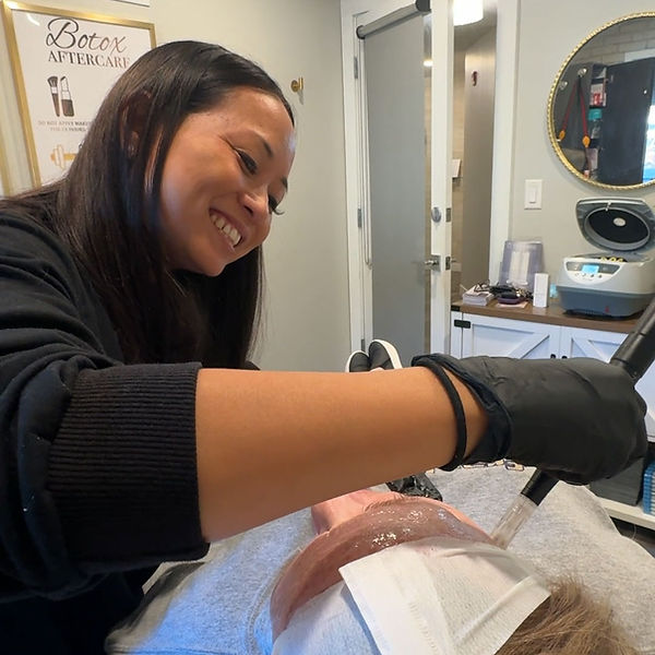 FL_Microneedling_IMG_8790_1080.jpg