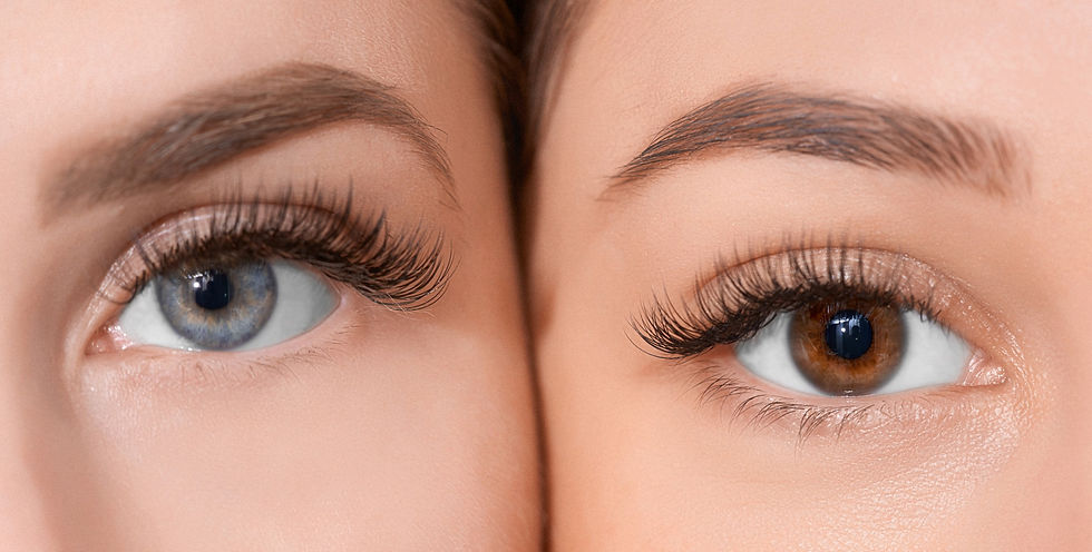 Eyes of different colours