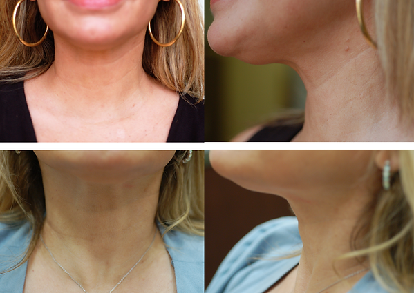 TREATMENT PACKAGES (6).png
