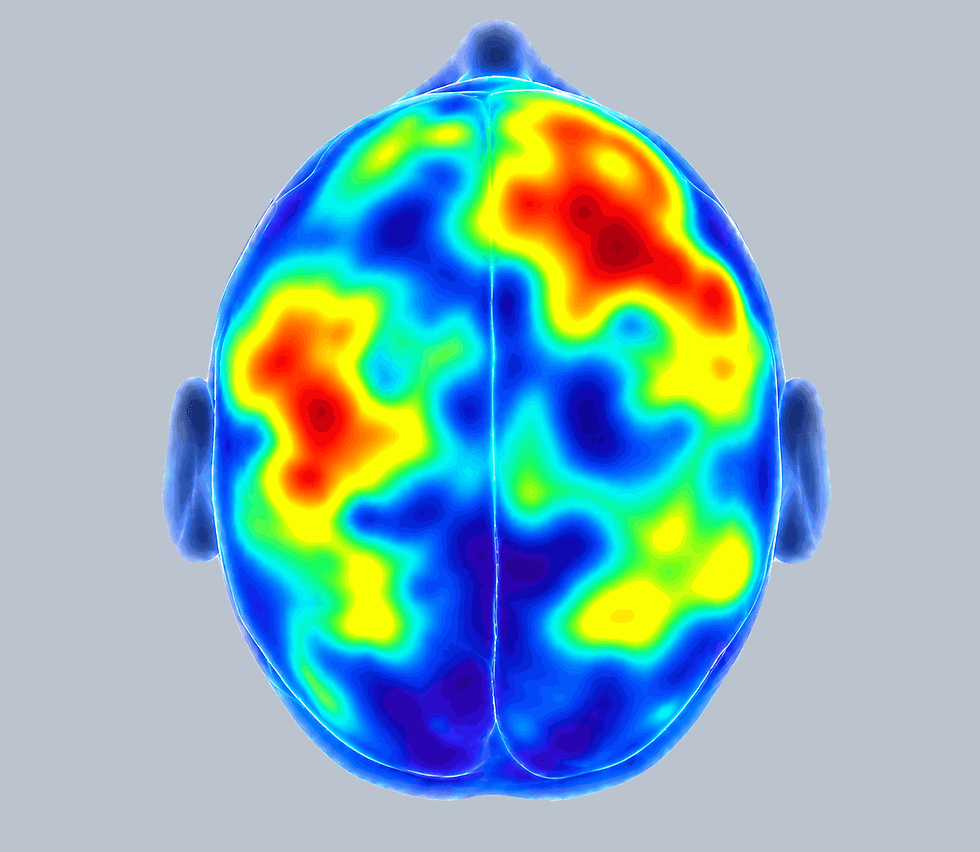 hersenactiviteit_pulserend_3sec_BAC3CE.gif