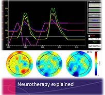 neurotherapyexplained.png