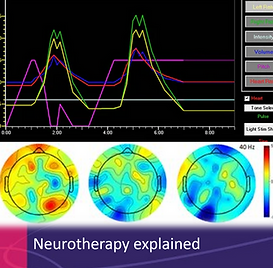 neurotherapyexplained.png