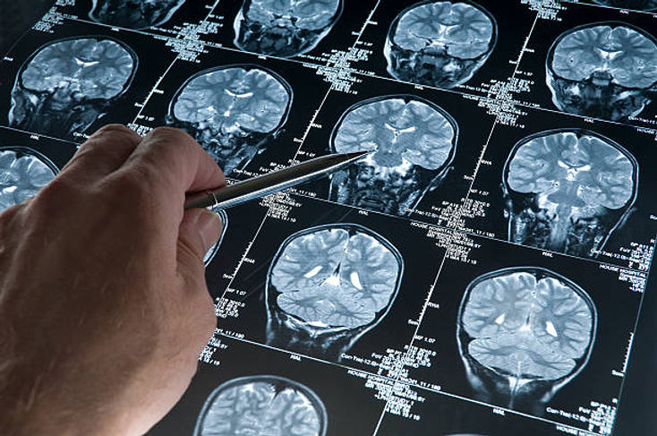 brainhealth_2.jpg