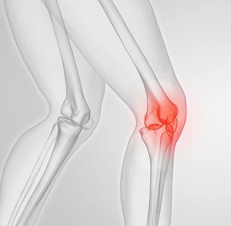 Tm_Tabs_knee.jpeg