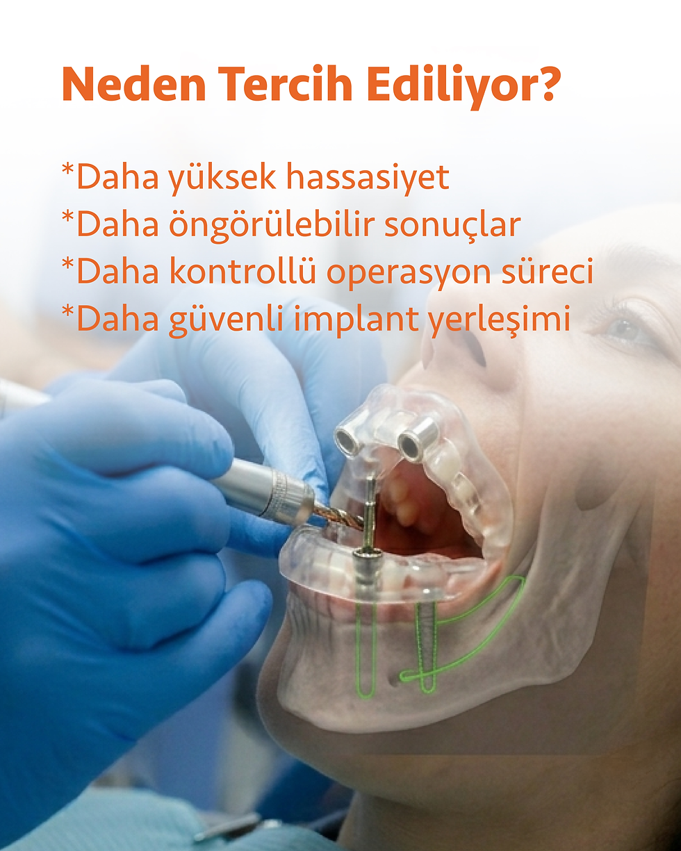 Rehberli implant cerrahisinde dijital planın uygulamaya aktarılmasını gösteren temsili tedavi görseli