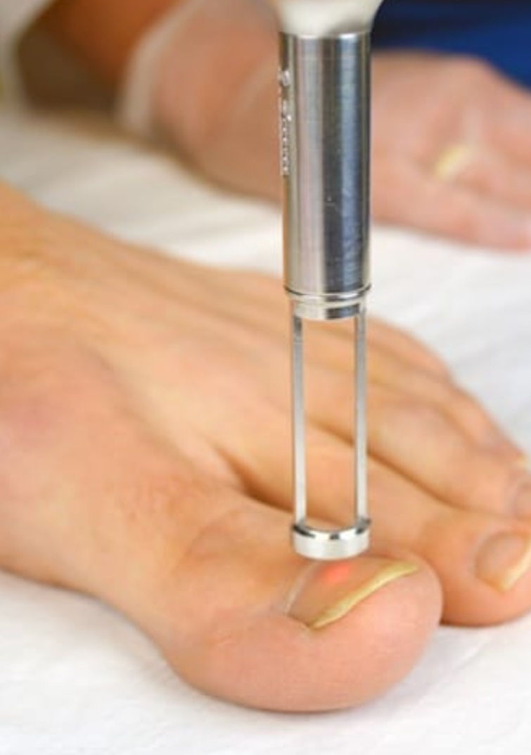 Thumbnail: Laser training, advanced facials, Fungal nails, Tattoo removal