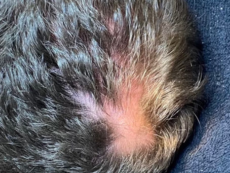 Augmenter la densité et la santé de ses cheveux de façon naturelle (photos réelles d’un patient)