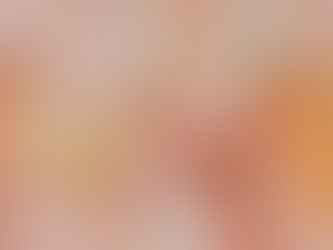 Bilateral Breast Reduction Costs and Rebate Eligibility