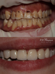 before and after