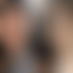 ศัลยกรรมตาที่ไหนดี