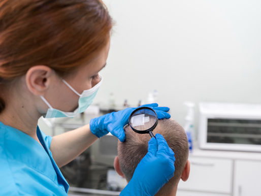 What No One Tells You About Getting a Hair Transplant in Ahmedabad
