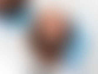 Best Hair Transplant Treatment in Ahmedabad at Low Cost