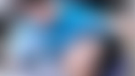 Oral 3D Scanner for Dental Industry