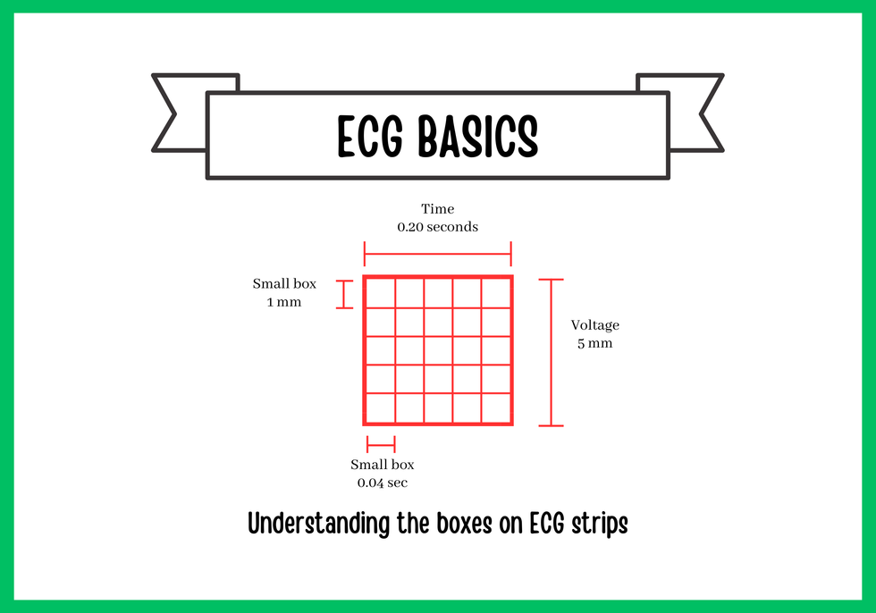 ECG Strip Basics