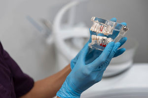 שיקום פה מחוסר שיניים במצבים של חסר עצם קיצוני