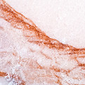 Pink Salt