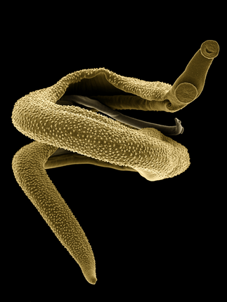 Pärchenegel - Schistosoma mansoni