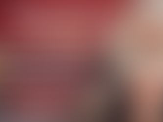 Patient experiencing knee discomfort, highlighting mild to moderate arthritis and non-surgical decision-making in orthopaedics.