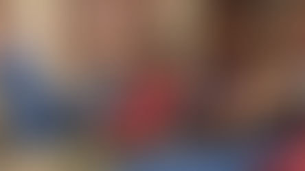 जबलपुर हॉस्पिटल में ज्यादा सुपारी, तम्बाखू खाने से होने वाले रोग पेरोटिड ट्यूमर एवं सबम्यूकस फाईब्रोसिस का किया सफल इलाज