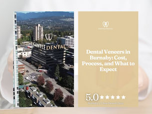 Dental Veneers in Burnaby: Cost, Process, and What to Expect