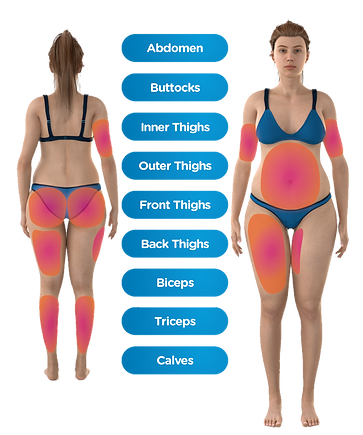 Emsculpt_Neo_PIC_Body-Parts-female.png