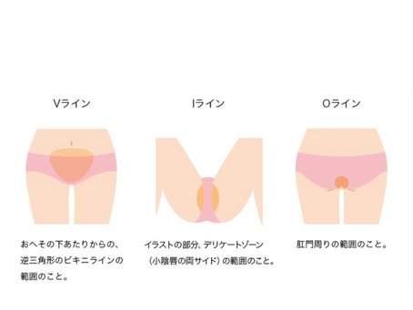 ハイジニーナ(無毛)