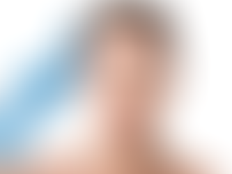 Beginner Guide to Botox for Fine Lines, Wrinkles, and Expression Marks