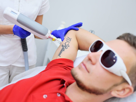 How Laser Tattoo Removal Helps Restore Confidence and Self-Image