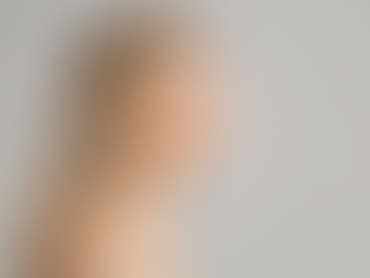 What to Expect From Nose Surgery in Dubai Cost