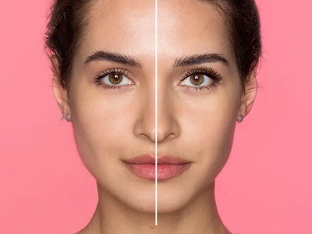 What Makes Eyebrow Lift Surgery Useful for Upper-Face Renewal?
