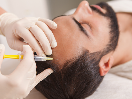Benefits of Hair Loss Treatment for Strengthening Hair Roots