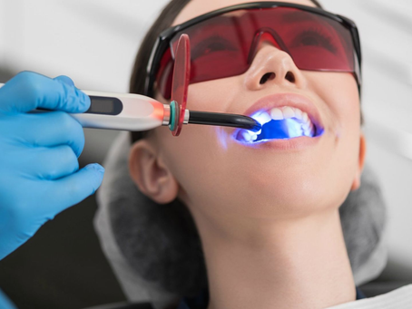 Teeth Whitening in Dubai for Brighter Teeth That Lift Your Appearance