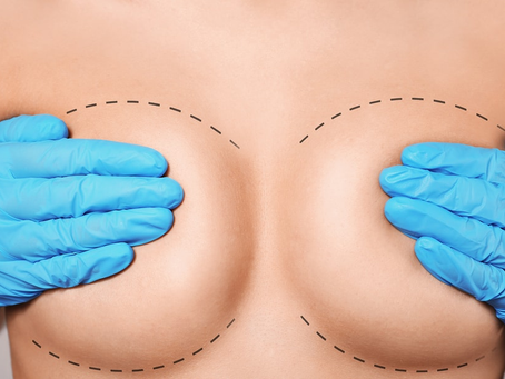 Breast Lift Surgery for Beautiful, Lifted Results