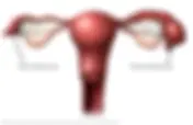 Understanding Pelvic Inflammatory Disease (PID) and Fitz-Hugh-Curtis Syndrome