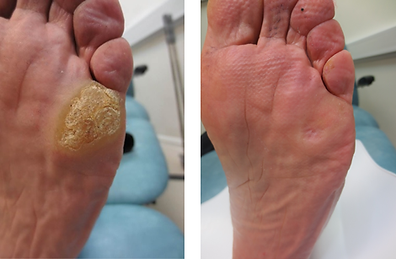 SWIFT-PATIENT-3-BEFORE-AND-AFTER-2-EP.png