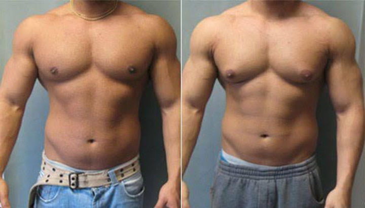 man breasts.jpg