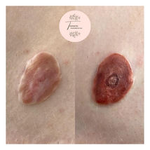 Top Surgery Nipple Tattoo