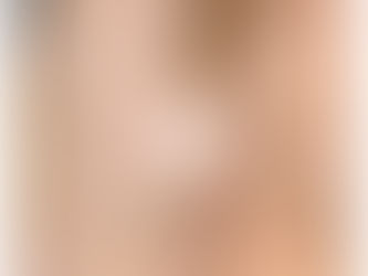 Comparaison avant-après de la peau d'une cicatrice au coude. Visuel rose au centre avec le texte "Tamara Paramedical".