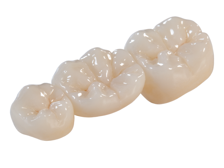 Quality BruxZir, Zirconia and E-Max Crowns